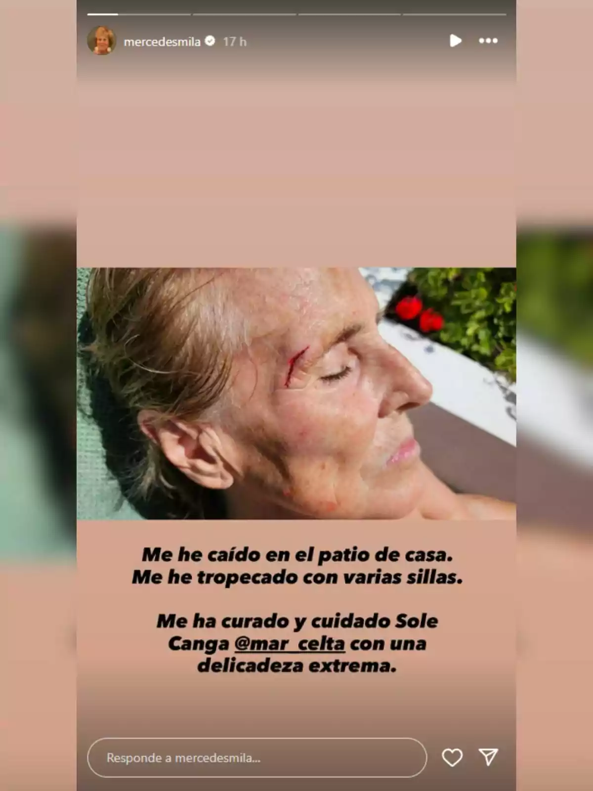 Mercedes Milá estirada amb una ferida al front i la cara malmesa, acompanyada d’un text explicant que va caure al pati de casa seva i va ser atesa amb delicadesa per una persona esmentada. Mercedes Milá estirada amb una ferida al front i la cara malmesa, acompanyada d’un text explicant que va caure al pati de casa seva i va ser atesa amb delicadesa per una persona esmentada.