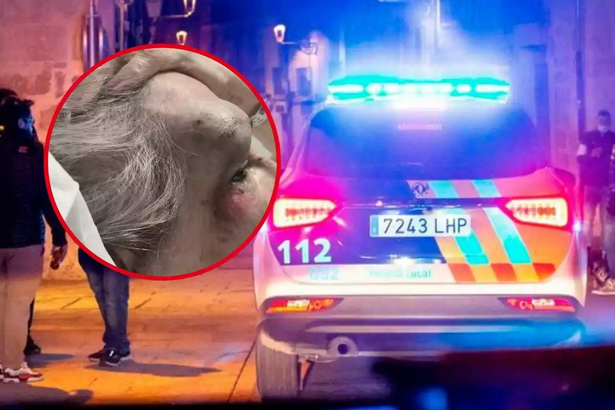 Coche de policía con las luces encendidas en una calle de noche y un círculo que muestra el rostro de una persona mayor con una herida en la frente