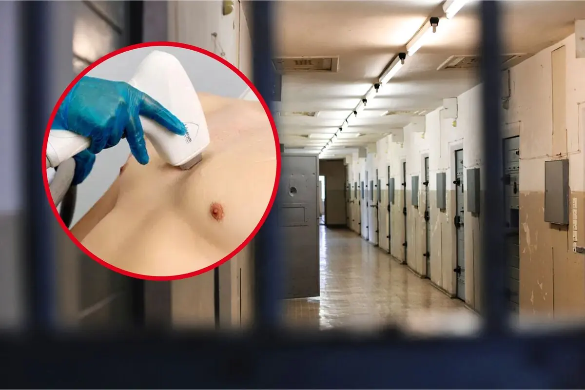 Pasillo de una prisión con un recuadro que muestra una persona recibiendo un tratamiento de depilación en el pecho