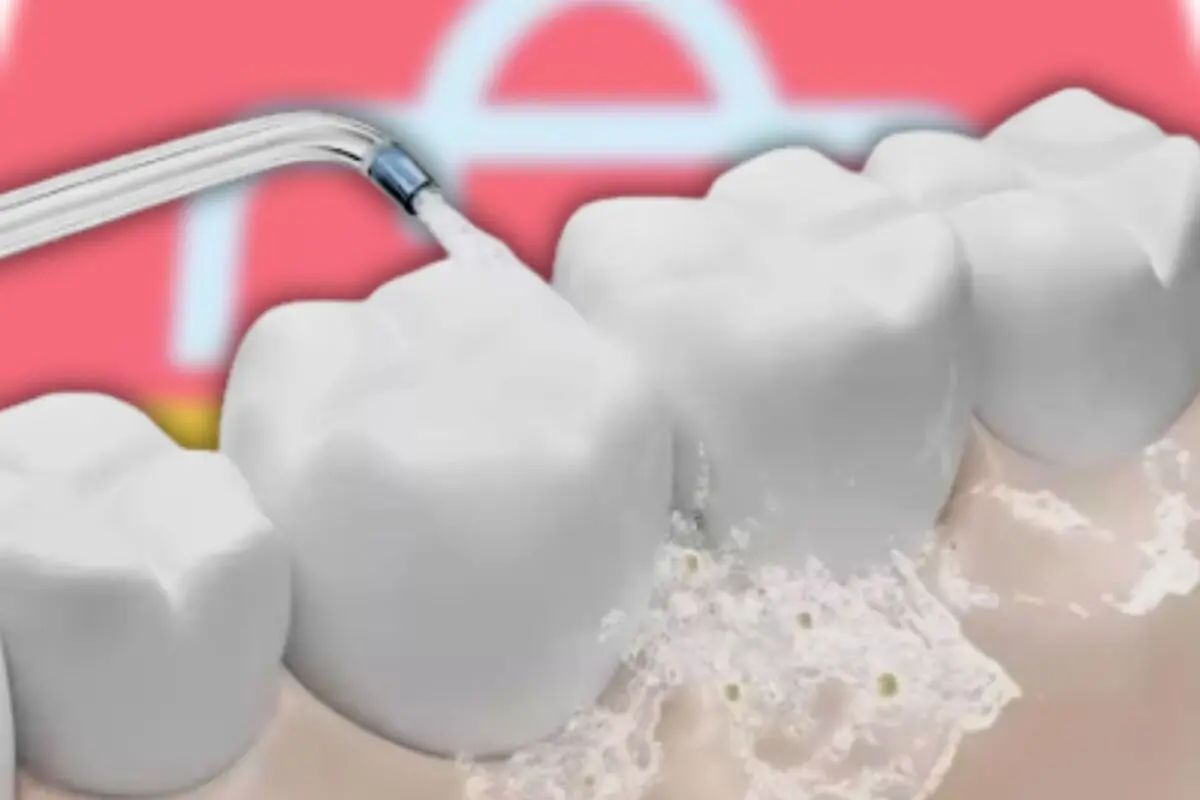 Irrigador dental limpiando los espacios entre muelas blancas sobre fondo rosa