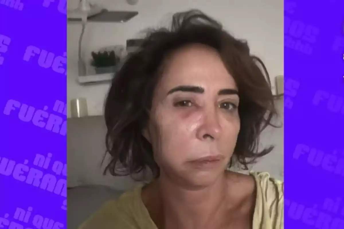 Una persona amb expressió seriosa i l'ull esquerre inflat, amb fons morat i text borros. Una persona amb expressió seriosa i l'ull esquerre inflat, amb fons morat i text borros.