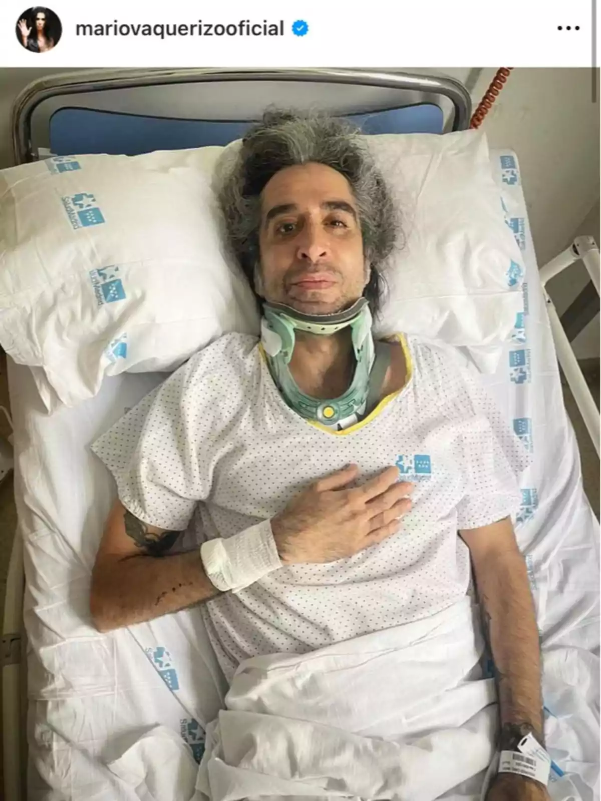 Una persona estirada en un llit d'hospital amb un collaret i una bata blanca, amb una mà sobre el pit.