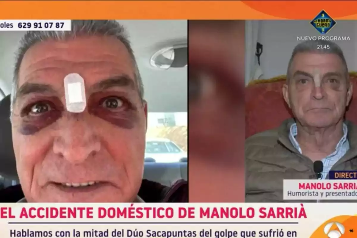 Manolo Sarriá con un vendaje en la frente y moretones alrededor de los ojos aparece en dos imágenes en Y ahora Sonsoles, una en un coche y otra en un programa de televisión.