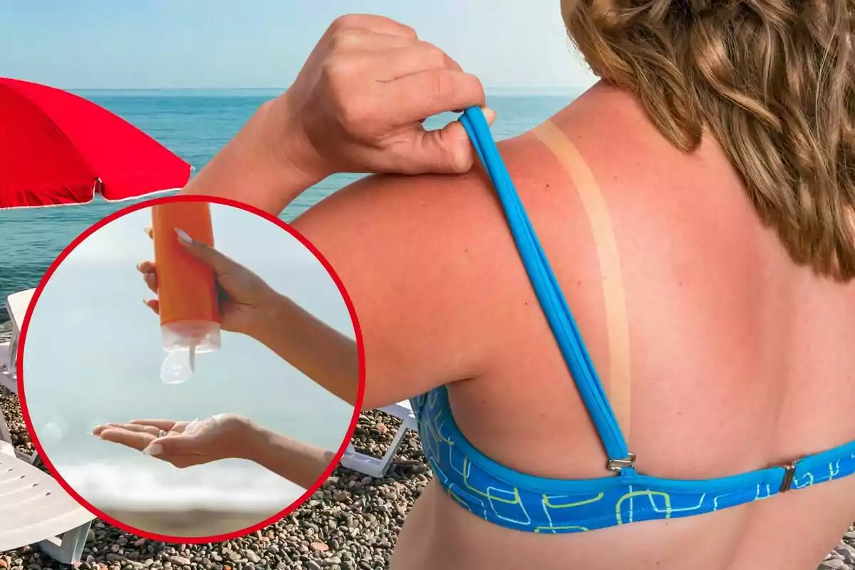 Una dona ensenya la cremada del sol a la platja, i al cercle, un pot de protecció solar